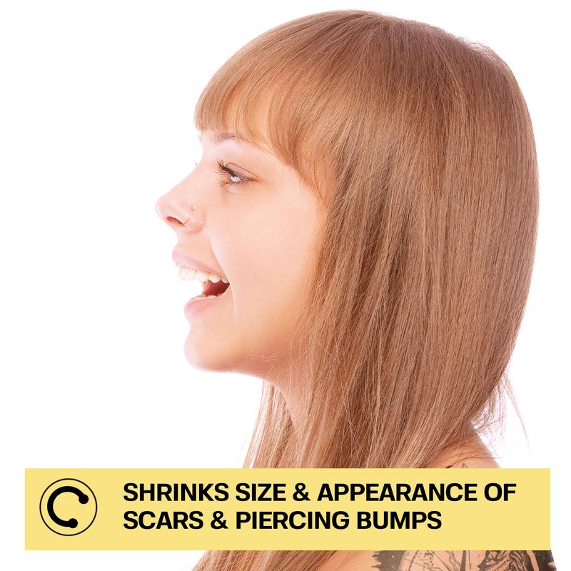 Piercing Bump Treatment - Bump, Keloid & Scar Relief Oil