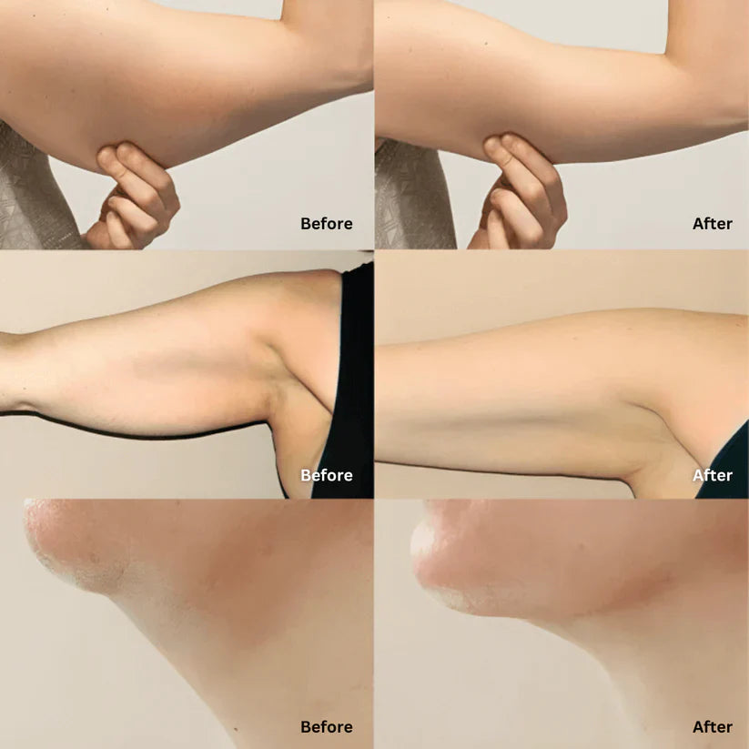 Lympflow®  Lymphatic Drainage Extract