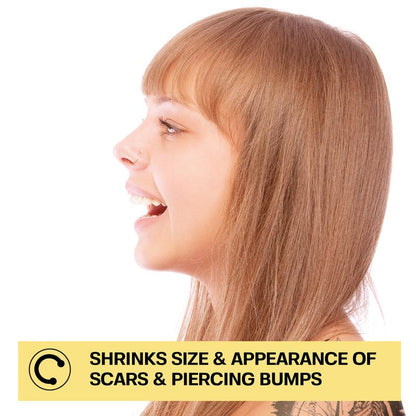 Piercing Bump Treatment - Bump, Keloid & Scar Relief Oil