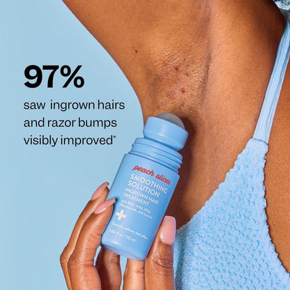 Aurolya Smoothing Solution Ingrown Hair Treatment