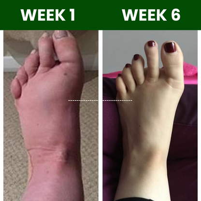 Lympflow®  Lymphatic Drainage Extract