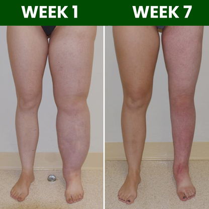 Lympflow®  Lymphatic Drainage Extract