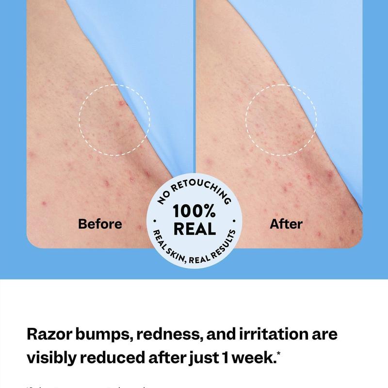 Aurolya Smoothing Solution Ingrown Hair Treatment