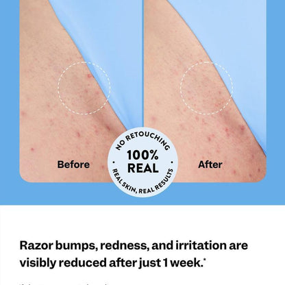 Aurolya Smoothing Solution Ingrown Hair Treatment